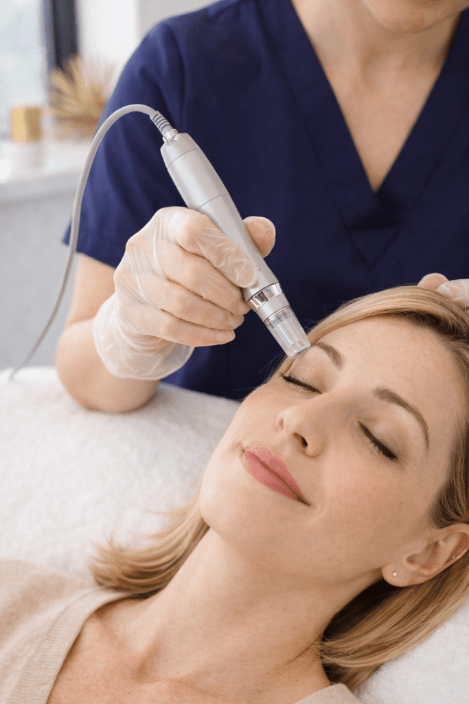 microneedling treatment during a glass skin facial to improve texture, tone, and overall skin radiance
