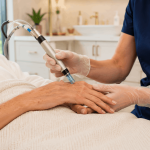 Hand rejuvenation procedure targeting age spots and crepey skin.